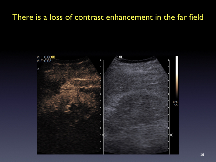 ICUS-2017-commonly-asked-questions-CEUS_-003.016