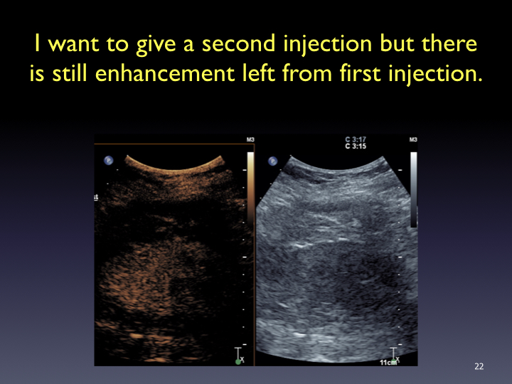 ICUS-2017-commonly-asked-questions-CEUS_-003.022